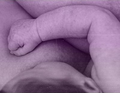 Postpartum