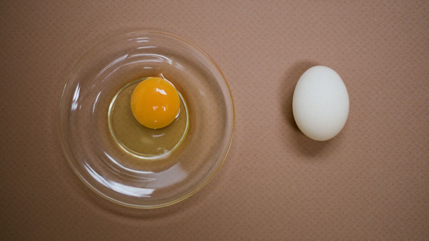 Hayley shares her story of egg freezing and an endometriosis diagnosis in her thirties
